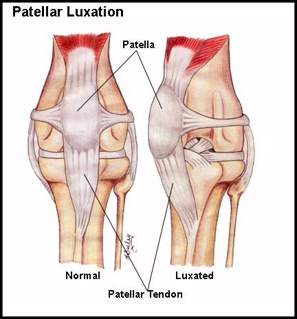 patella out of place